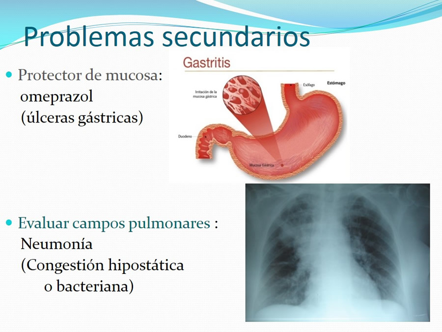 Fractura de la Bveda Craneal y Trauma Craneoenceflico